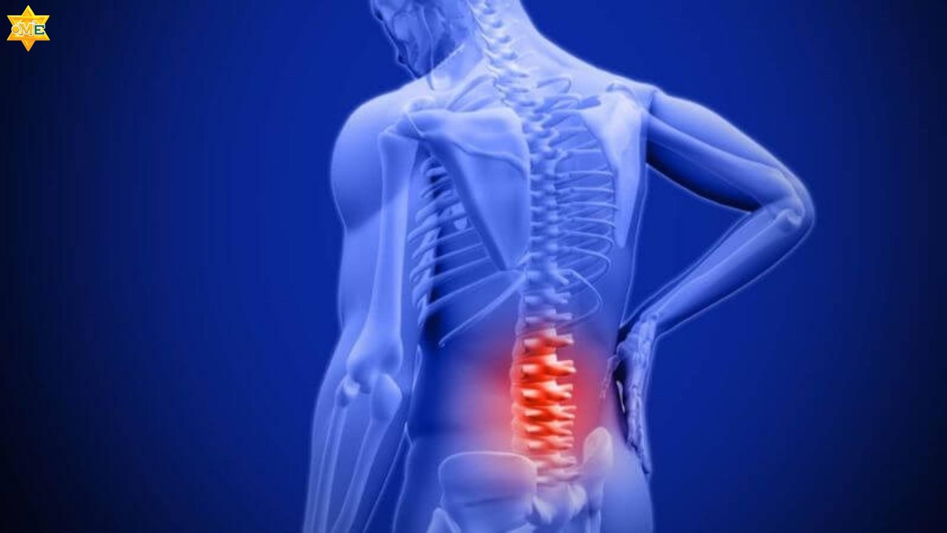 bài tập Yoga cho người đau lưng